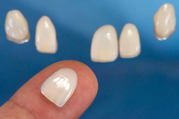 Porcelain Veneers in Minot, ND