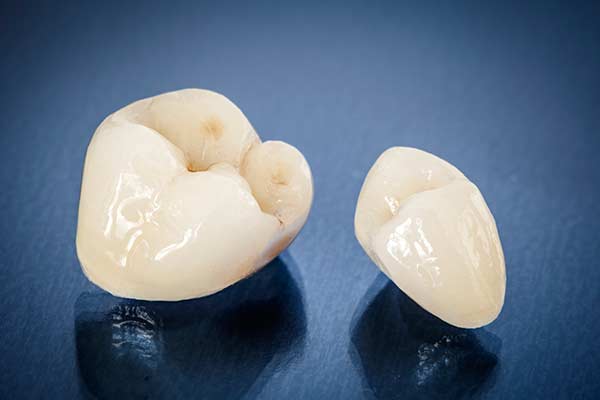Dental Crowns in Minot, ND